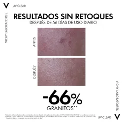 Vichy Capital Soleil UV-age daily SPF50+ 40ml Vichy Capital Soleil UV-age daily SPF50+ 40ml