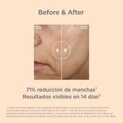 Isdinceutics Melaclear Serum Antimanchas 30ml Isdinceutics Melaclear Serum Antimanchas 30ml