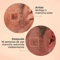 Segle Glicolmix Exfoliante, 30 ml Segle Glicolmix Exfoliante, 30 ml
