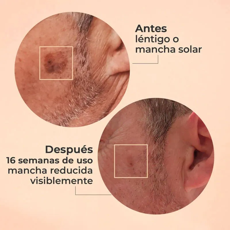 Segle Glicolmix Exfoliante, 30 ml Segle Glicolmix Exfoliante, 30 ml