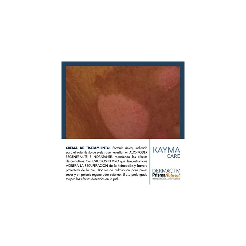 Prisma Natural Kayma Care, 100ml.