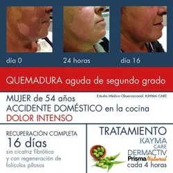 Prisma Natural Kayma Care, 100ml.