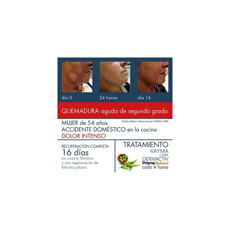 Prisma Natural Kayma Care, 100ml.