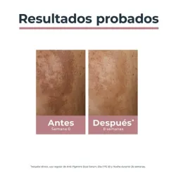 Eucerin Anti-Pigment Dual Serum, 30ml | Farmacia Barata