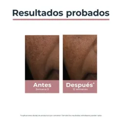 Eucerin Anti-Pigment Lápiz Corrector Manchas, 5ml | Farmacia Barata Eucerin Anti-Pigment Lápiz Corrector Manchas, 5ml | Farmacia Barata