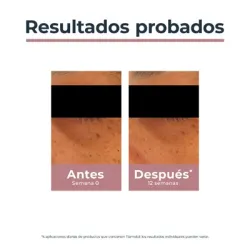 Eucerin Anti-Pigment contorno de ojos, 15 ml