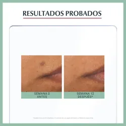 Eucerin Dermopure oil control serum triple efecto, 40ml Antimanchas Eucerin Dermopure oil control serum triple efecto, 40ml Antimanchas