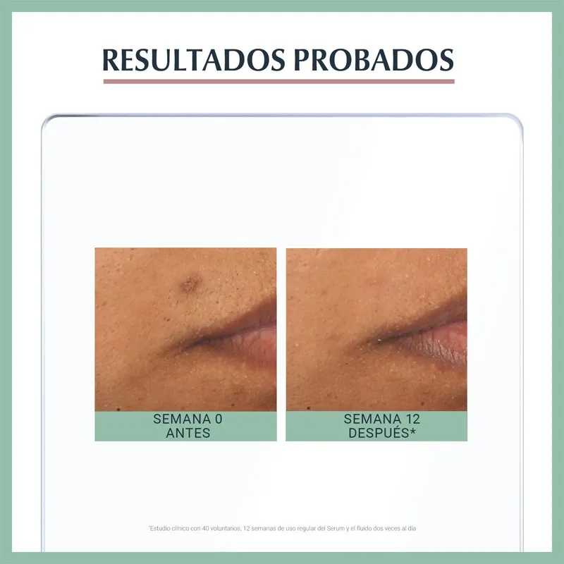 Eucerin Dermopure oil control serum triple efecto, 40ml Antimanchas Eucerin Dermopure oil control serum triple efecto, 40ml Antimanchas