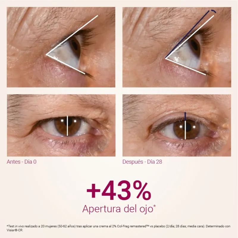 Primaderm Xpert Collageneur rejuvenece tu mirada