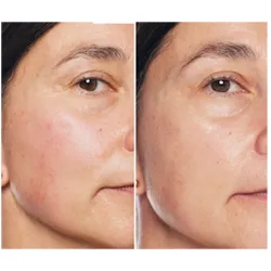 Erborian serum skin therapy, 30 ml Erborian serum skin therapy, 30 ml