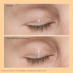 Perricone MD Neuropeptide Eyelid Lift Serum 15ml | Farmacia Barata