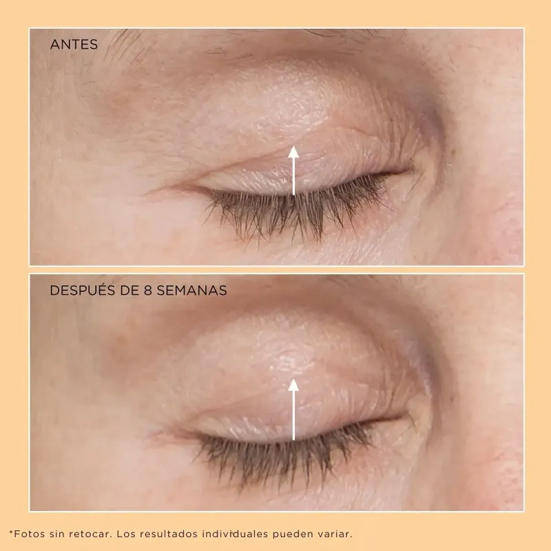 Perricone MD Neuropeptide Eyelid Lift Serum 15ml | Farmacia Barata