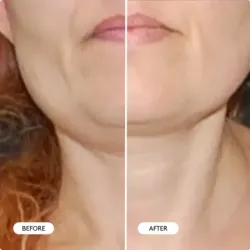 Cocunat Clinical Sculpt Sérum Remodelador Doble Mentón | Farmacia Barata