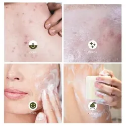 Essabo jabon piel grasa y acne ecologico 120gr. | Farmacia Barata