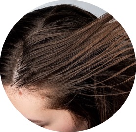 Cabello Graso