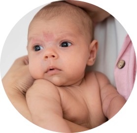 Piel atópica en bebés y niños 