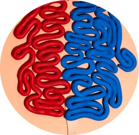 Colon irritable