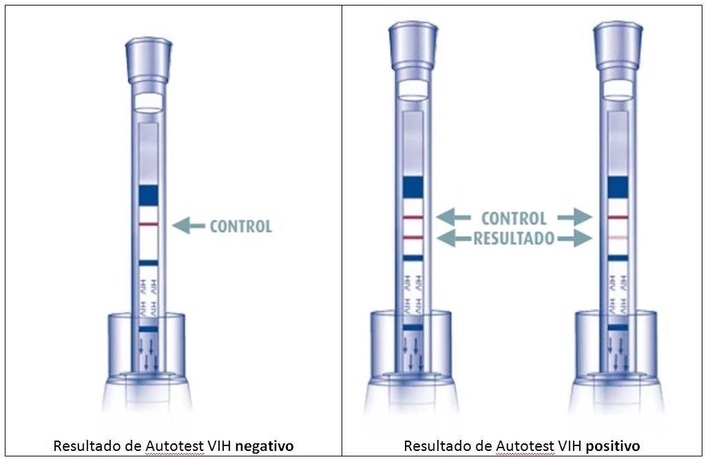 autotest-vih-resultado