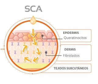 Efecto loop ampollas endocare