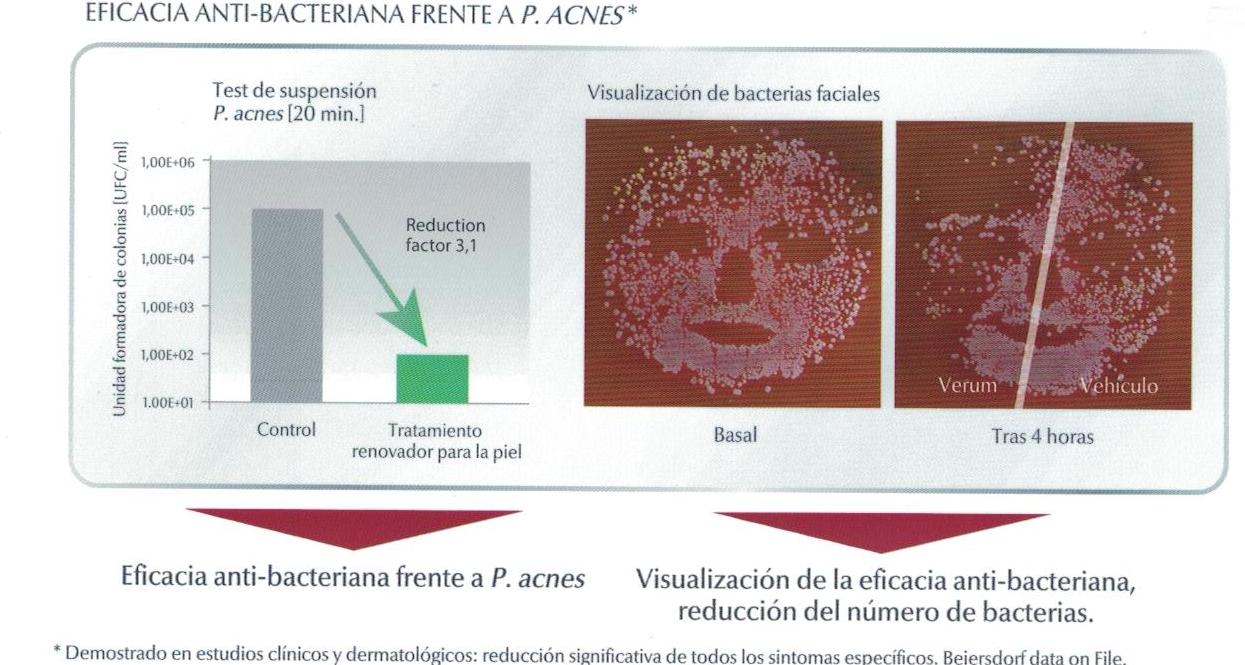 oil control tratamiento efectividad